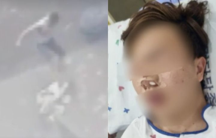 [뉴시스] 가해 남성에게 무차별 폭행을 당한 고3 A군의 모습. (출처=JTBC '사건반장') *재판매 및 DB 금지