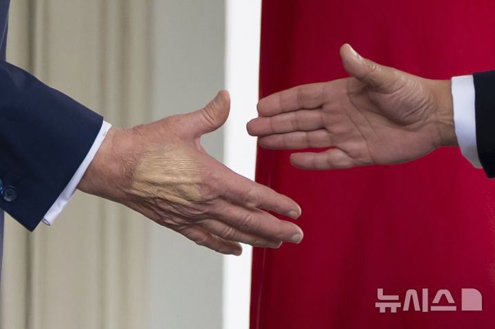 [워싱턴=AP/뉴시스] 지난 16일(현지 시간) 도널드 트럼프 대통령이 백악관 집무실에서 살만 빈 하마드 알 칼리파 바레인 왕세자 겸 총리와 회담에 앞서 악수하고 있다. 트럼프 대통령의 손에는 멍 자국을 가리기 위한 화장품이 덧발려 있다. 올해 79세인 트럼프 대통령이 종아리 붓는 증상으로 종합 검진한 결과 만성 정맥부전을 진단받았다. 2025.07.18.