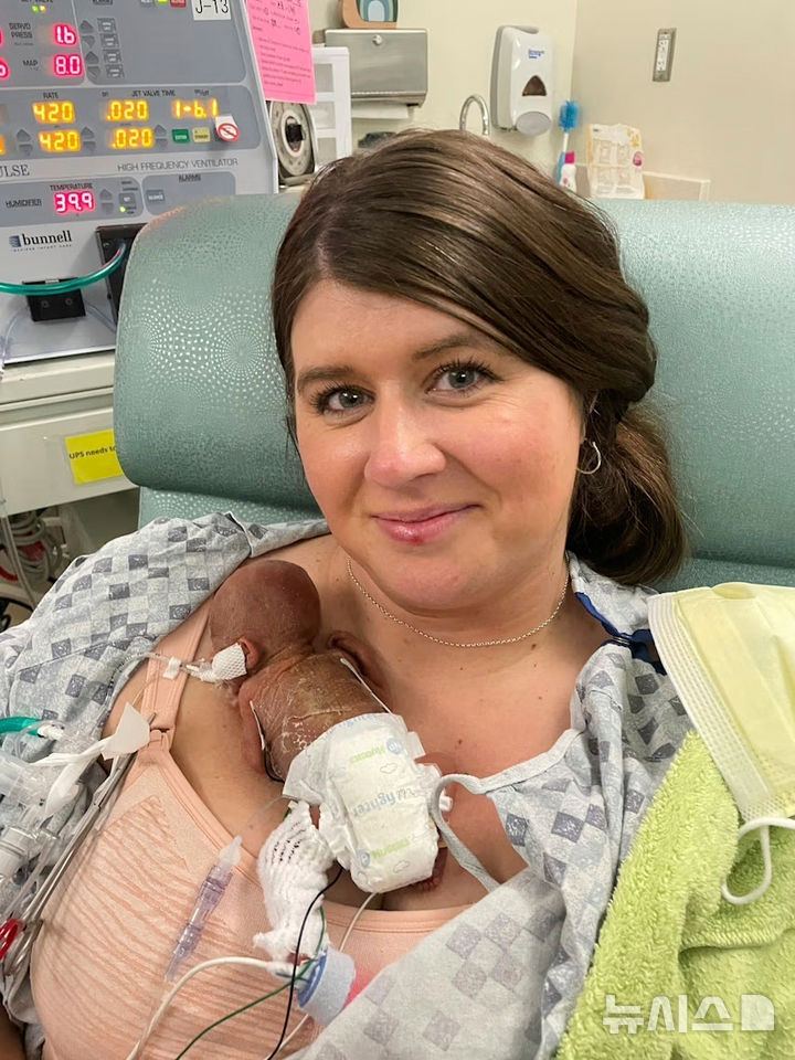 [아이오와=AP/뉴시스] 아이오와주 아이오와시티에 위치한 아이오와대학병원 스테드 가족 아동병원에서 몰리가 아들 내시를 안고 있는 모습이다. 2024.08.02.