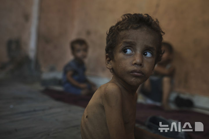 [가자시티=AP/뉴시스] 23일(현지 시간) 가자시티 샤티 난민 캠프에 머물고 있는 야잔 아부 풀(2)의 모습. 굶주림으로 인해 뼈가 드러나고 앙상한 모습이다. 2025.07.25.