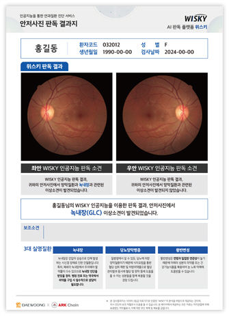 [서울=뉴시스] 위스키는 안저카메라로 촬영한 망막 이미지를 실시간으로 분석해 황반변성, 당뇨병성 망막병증, 녹내장 등 3대 실명 유발 질환을 판독하는 AI기반 의료 솔루션이다. (사진=아크 제공) 2025.07.25. photo@newsis.com *재판매 및 DB 금지