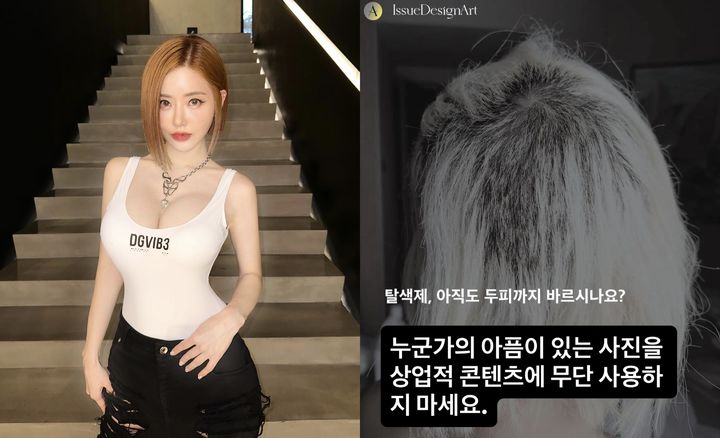 [서울=뉴시스] 미용 시술 중 두피와 모발 손상 사고를 당한 DJ 소다(왼쪽)가 본인 사진을 이용한 상업적 콘텐츠 제작에 분노를 드러냈다. (사진=DJ 소다 인스타그램 캡처) 2025.07.25. photo@newsis.com *재판매 및 DB 금지