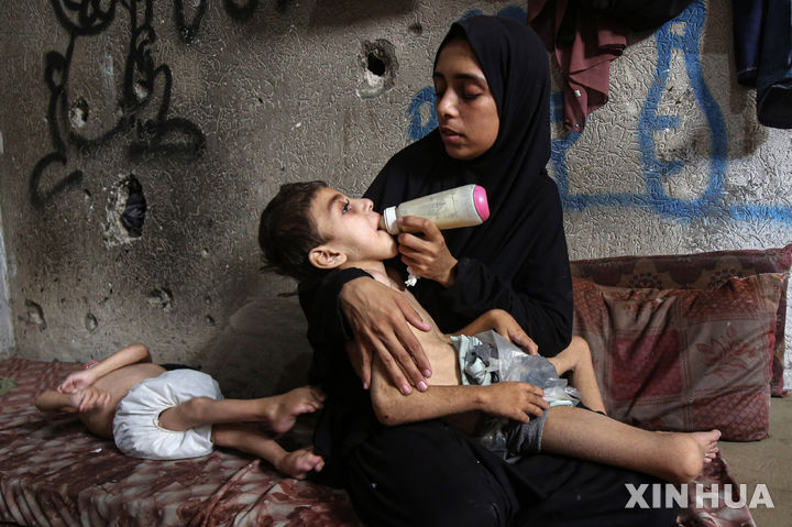 [가자시티=신화/뉴시스] 지난 7월25일(현지 시간) 가자지구 가자시티의 한 대피소에서 영양실조와 뇌성마비로 고통받는 팔레스타인 어린이들이 누워 있는 모습. 2025.08.08.