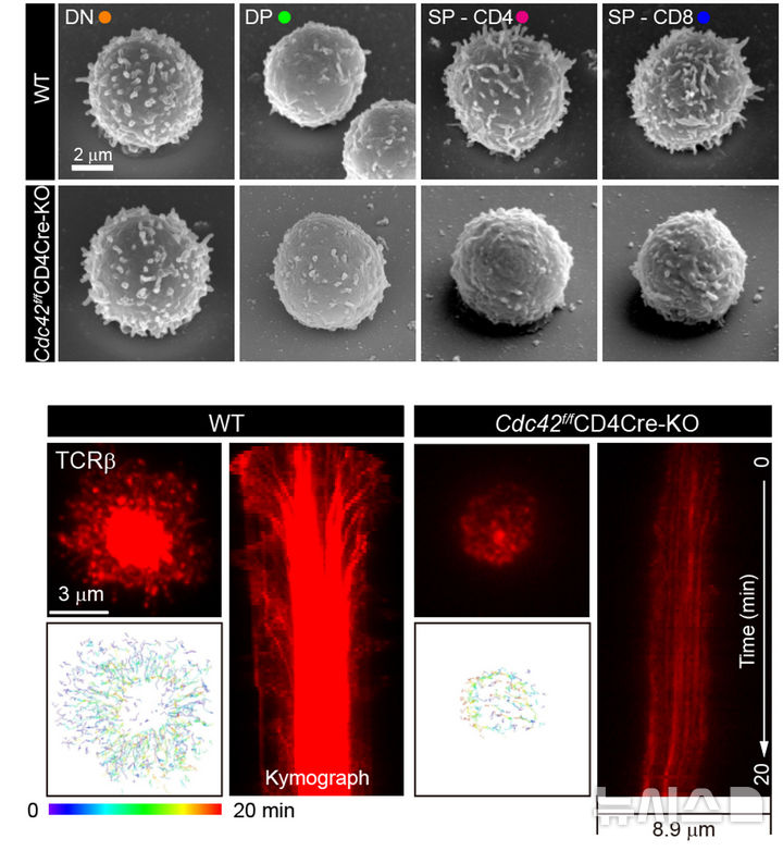 [광주=뉴시스] 광주과학기술원(지스트·GIST) 전창덕 생명과학과 교수 연구팀이 T세포 표면에 존재하는 미세융모의 형성과 면역 기능을 조절하는 핵심 단백질(Cdc42)의 역할을 규명하고 새로운 면역 치료제 개발 가능성을 제시했다. (사진=지스트 제공) 2025.07.29. photo@newsis.com