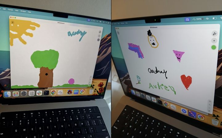 [서울=뉴시스] 20년간 전신마비 상태로 살아온 미국의 한 여성이 일론 머스크가 설립한 뇌신경과학 스타트업 '뉴럴링크'의 칩을 뇌에 이식한 뒤 생각만으로 컴퓨터를 조작할 수 있게 됐다. (사진=@NeuraNova9 엑스 캡처) 2025.07.30 *재판매 및 DB 금지