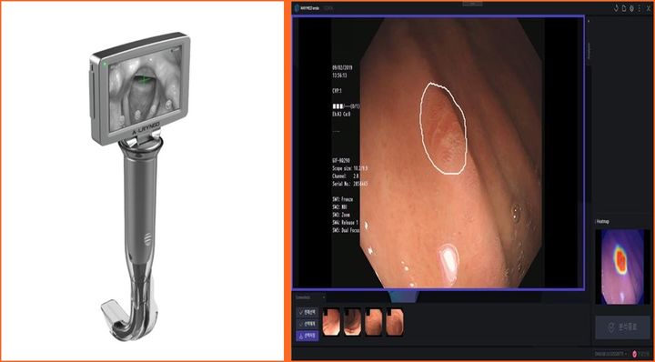 [대전=뉴시스] 미국과 베트남 공공기관서 해외실증을 거치는 AI 기반 스마트 비디오 후두경(왼쪽)과 베트남서 실증하는 AI 내시경 영상 실시간 분석 및 암 발견·치료전략에 도움을 주는 의료기기.(사진=조달청 제공) *재판매 및 DB 금지