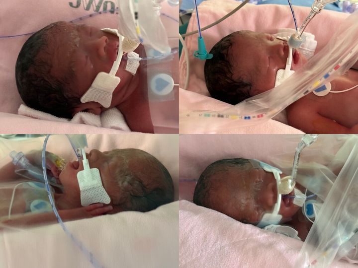 [뉴시스] A씨가 올린 네쌍둥이 사진. (사진=에펨코리아 캡처) *재판매 및 DB 금지