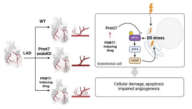 [서울=뉴시스] 심근경색에서 Prmt7의 기능. (사진=숙명여대 제공) 2025.08.12. photo@newsis.com *재판매 및 DB 금지