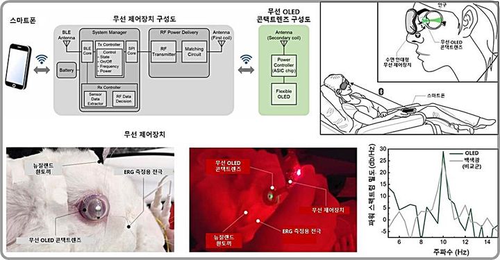 [대전=뉴시스] 무선 유기발광다이오드(OLED) 콘택트렌즈를 활용한 망막전위도 검사 시스템 모식도.(사진=KAIST 제공) 2025.08.12. photo@newsis.com *재판매 및 DB 금지