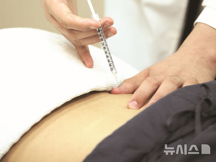 [서울=뉴시스] 약침 치료. (사진= 자생한방병원 제공)