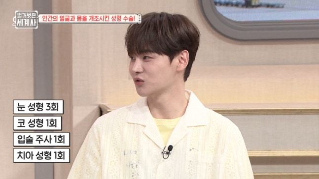 박서진 "눈 3번에 코·입술·모발…성형 안 한 데 없어"