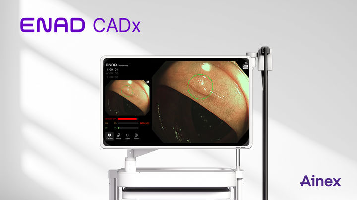 [서울=뉴시스] 13일 아이넥스코퍼레이션에 따르면 에나드 CADx는 단순한 병변 검출을 넘어, 병리 진단을 세 가지 유형으로 분류해 제시하는 기준을 갖춘 인공지능(AI) 기반 대장암 영상검출·진단보조 소프트웨어이다. (사진=아이넥스코퍼레이션 제공) 2025.08.13. photo@newsis.com *재판매 및 DB 금지