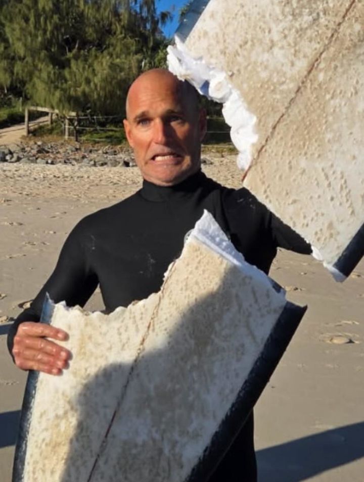 [뉴시스]호주에서 백상아리 공격을 당한 남성이 사건 직후 두 동강 난 서핑보드를 내보이고 있다.(사진=뉴욕포스트) 2025.8.19 