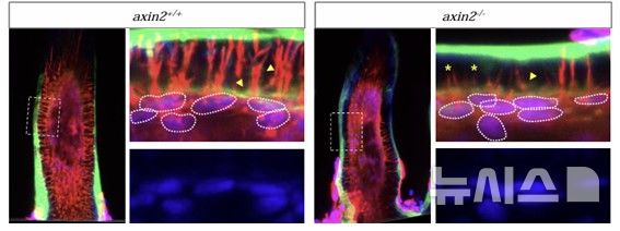 [서울=뉴시스] (좌)정상치아, (우)Axin2 결손치아. Axin2 결손치아에서 상아질의 발달이 저해됨을 관찰할 수 있다. (사진= 고려대의료원 제공)