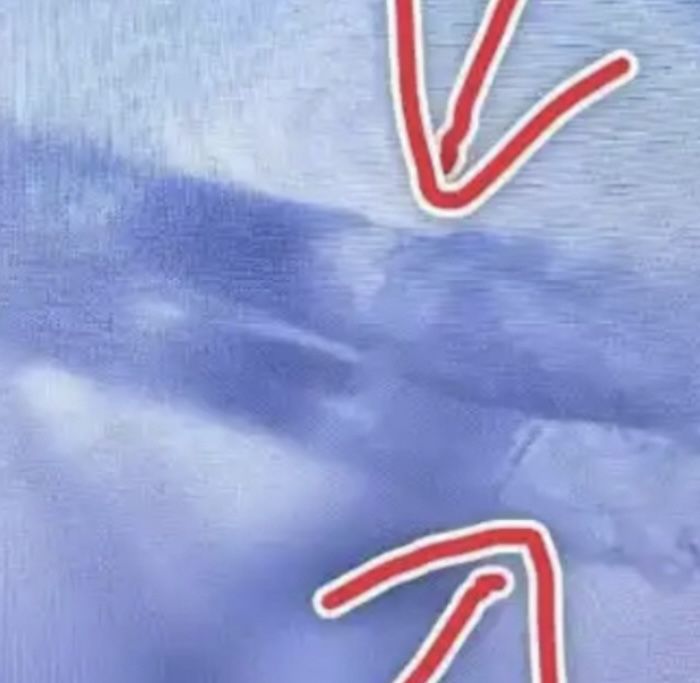 [뉴시스]속눈썹에 기생중인 모낭충(진드기) 모습.(사진=홍성신문)