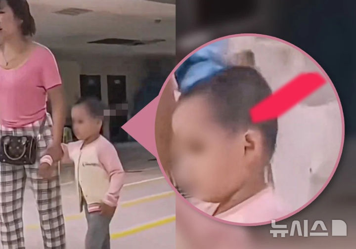 딸 머리에 흉기 꽂힌 채 걷는 모녀 '태연'…中 충격 영상