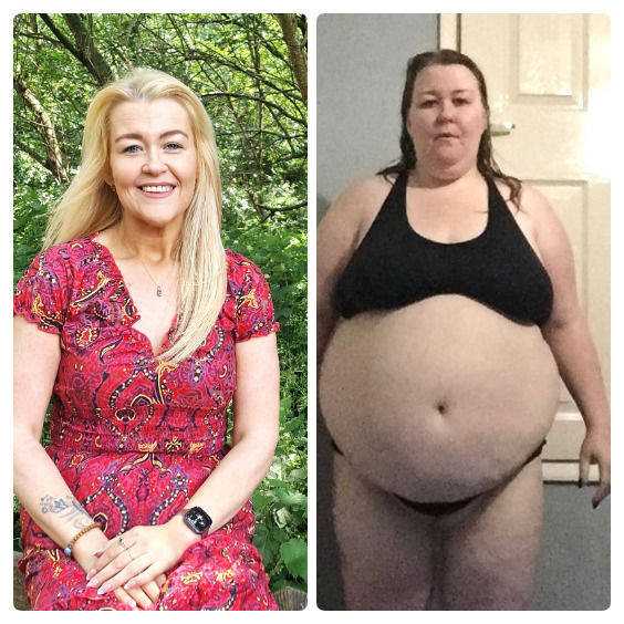 [뉴시스]영국의 한 여성이 다이어트에 성공해 127㎏을 감량했다. (사진=니드투노우) 2025.08.25 *재판매 및 DB 금지