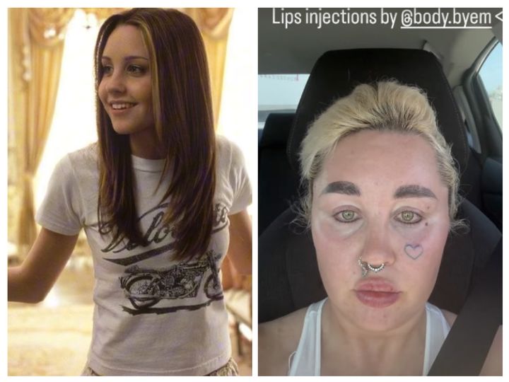 [뉴시스] 23일(현지시각) 미 매체 페이지식스에 따르면 아만다 바인즈(39)는 자신의 인스타그램에 입술 필러 시술 후 한층 도톰해진 입술과 함께 시술받은 업체를 태그한 스토리를 게재했다. 그녀는 2010년부터 음주운전, 마약, 정신 질환 등의 이슈들로 잠정 활동을 중단한 바 있다. (사진=영화 <What a Girl Wants> 캡처, 인스타그램 캡처 @Amanda Bynes) *재판매 및 DB 금지