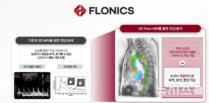 [서울=뉴시스] 플로우닉스 4차원 혈류 분석 기술 (사진=플로우닉스 제공)