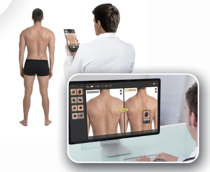 [서울=뉴시스] 스페클립스가 출시한 더맵(DerMap)은 스마트폰으로 전신을 촬영하고 병변의 악성 가능성을 선별하고, 정량회된 리포트를 제공한다. (사진=스페클립스 제공) 2025.08.28. photo@newsis.com *재판매 및 DB 금지