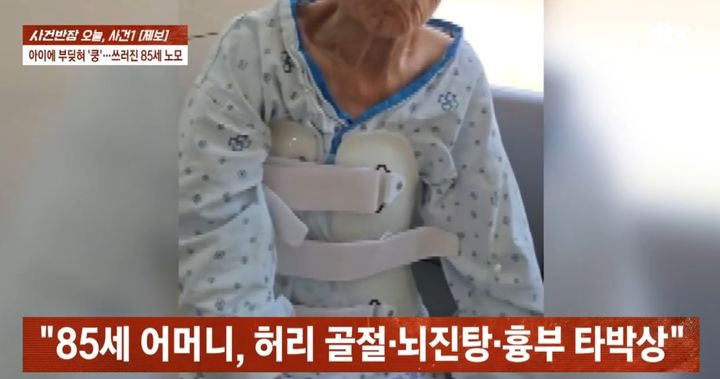 [뉴시스] 8세 여아와 부딪혀줒ㅇ상을 입은 80대 노모가 뇌진탕과 허리 골절, 흉부 타박상 등의 중상을 입고 한 달 이상 병원에서 입원 치료를 받았다. 2025.09.01. (사진=JTBC'사건반장' 갈무리). *재판매 및 DB 금지 *재판매 및 DB 금지