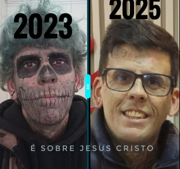 [뉴시스]브라질에서 가장 많은 문신을 한 남성이 전신 문신 제거 과정을 공개하며 새로운 삶을 살고 있다.(사진=인스타그램/@leandrodesouzabless).2025.09.04&nbsp; *재판매 및 DB 금지