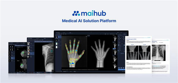 [서울=뉴시스] 마이허브는 이번 인수를 통해 뷰노메드 본에이지는 마이허브의 의료 AI 플랫폼 마이링크(maiLink)에 통합되며 '마이:본에이지(mai:BoneAge)라는 이름으로 선보인다고 15일 밝혔다. (사진=마이허브 제공) 2025.09.15. photo@newsis.com *재판매 및 DB 금지