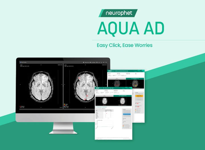 [서울=뉴시스] 뇌 질환 진단·치료 인공지능(AI) 전문기업 뉴로핏은 뇌 영상 검출·진단 보조 소프트웨어 '뉴로핏 아쿠아 AD 플러스(Neurophet AQUA AD Plus)'가 혁신의료기술로 선정됐다고 16일 밝혔다. (사진=뉴로핏 제공) 2025.09.16. photo@newsis.com *재판매 및 DB 금지