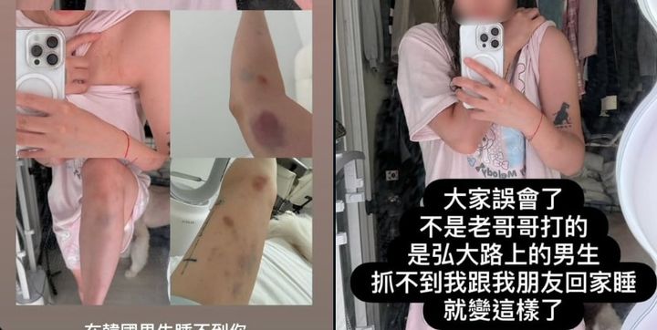 [서울=뉴시스] 구독자 46만명을 보유한 대만 유튜버 B씨는 친구와 서울 홍대 거리를 걷다 모르는 남성으로부터 폭행을 당했다고 주장하는 글을 게시했다. (사진=SNS 갈무리) photo@newsis.com *재판매 및 DB 금지