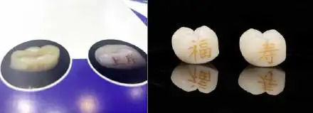 [뉴시스] 최근 상하이의 한 치과 의사는 소셜미디어를 통해 "发财(돈을 번다), 上岸(목표를 달성한다)같은 문구가 환자들 사이에서 특히 인기다"며 관련 사례를 소개했다.(사진= 광명망 캡쳐).2025.09.18 *재판매 및 DB 금지