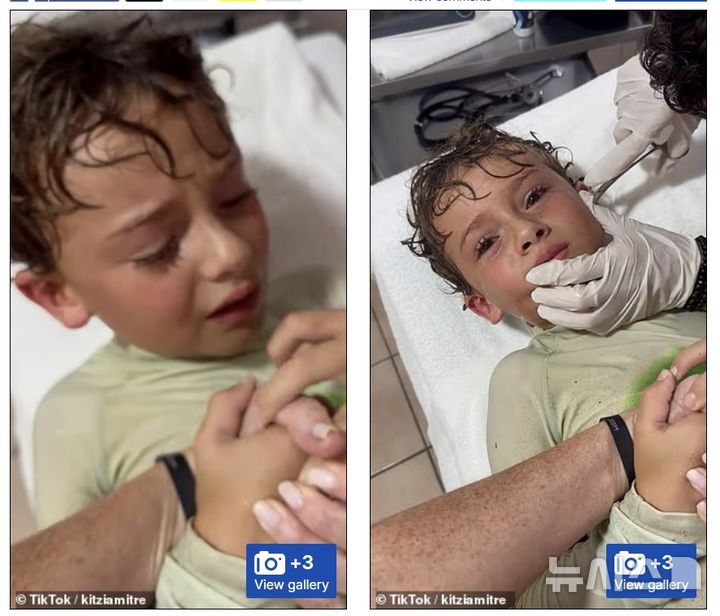 [서울=뉴시스]페드로가 귀에 들어간 게를 제거하기 위해 병원 진료대에 누워 있다. (사진:데일리메일 캡처)2025.09.19.