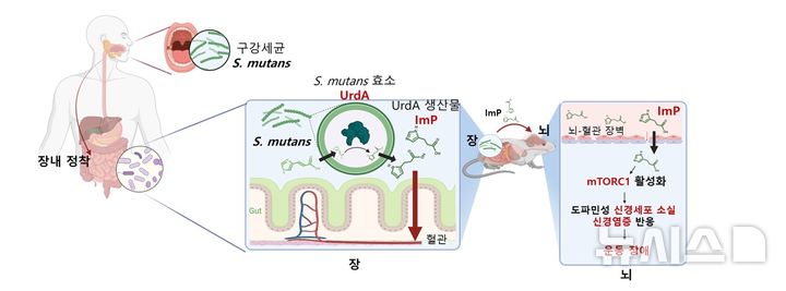 [포항=뉴시스] 송종욱 기자 = 포스텍-성균관대-서울대 연구팀이 공동으로 구강세균이 장에서 만든 대사산물이 파킨슨병을 유발하는 메커니즘을 밝혀냈다. 사진은 구강세균의 장내 정착에 따라 생성되는 대사체가 뇌에서 축적과 파킨슨병의 유발 모델 모식도. (사진=포스텍 제공) 2025.09.19. photo@newsis.com