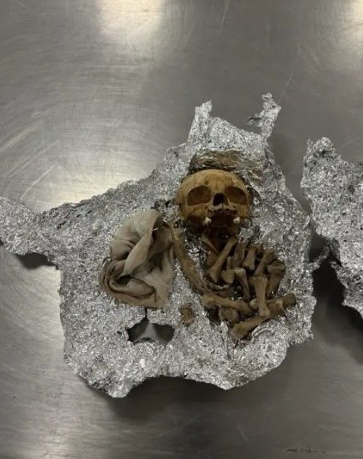 [서울=뉴시스] 미국에서 알류미늄 포일에 해골을 숨겨 입국하려던 한 여행객이 세관 직원에 의해 적발되는 사건이 발생했다. (사진=뉴욕포스트 캡처) 2025.09.19 *재판매 및 DB 금지