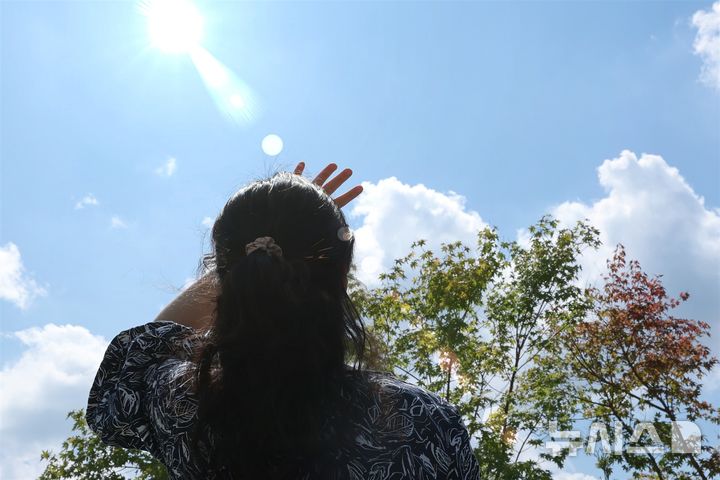 [서울=뉴시스] 백반증은 강한 자외선에 노출될수록 악화될 수 있다. (사진= 고려대학교 안산병원 제공)