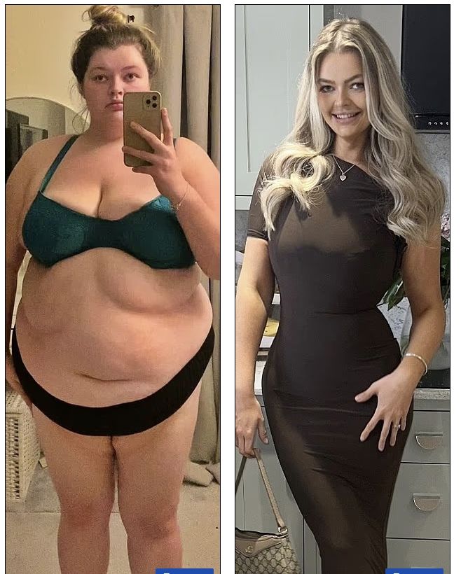 [서울=뉴시스]엘리 제프리스가 체중을 감량하기 전(왼쪽)과 후(오른쪽)의 모습. (사진출처: 데일리메일 캡처) 2025.09.29.