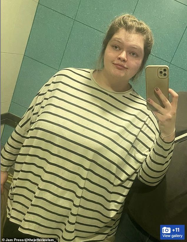 [서울=뉴시스]엘리 제프리스 살 빼기 전 모습. (사진출처: 데일리메일 캡처) 2025.09.29.