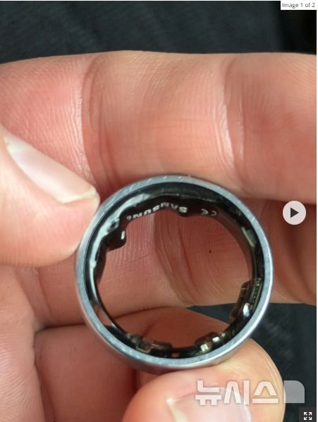 [서울=뉴시스] 부풀어 오른 갤럭시링을 손가락에서 빼낸 이후의 모습. (사진출처: 다니엘 로타르 엑스)