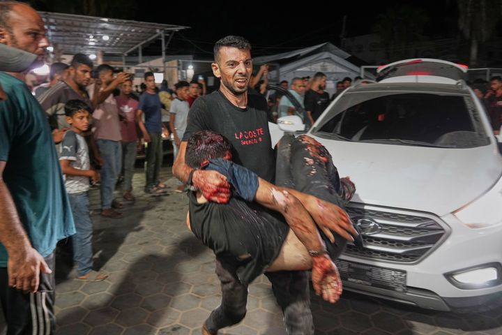 [데이르알발라=AP/뉴시스]&nbsp; 가자지구 중부 데이르알발라 시내에서 한 남성이 이스라엘군의 목공소와 카페 공습으로 부상한 남성을 알아크사 병원으로 옮기고 있다. 2025.10.02.