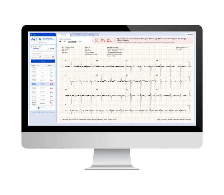 [서울=뉴시스] 2일 메디컬에이아이는 자사가 보유한 '심전도 분석 인공지능 알고리즘을 활용한 심장질환 진단 기술'을 국가전략기술로 확인했다.고 밝혔다. (사진=메디컬에이아이 제공) 2025.10.02. photo@newsis.com *재판매 및 DB 금지