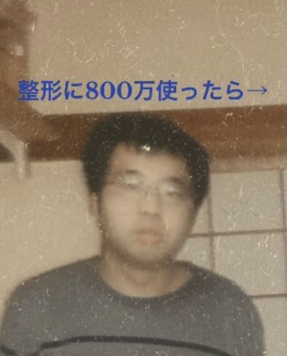 [서울=뉴시스]800만엔(약 7500만원)을 들여 얼굴 성형을 한 일본 남성 '토시키'씨의 성형 전 모습.(사진출처: 마이도나뉴스 홈페이지 캡처) 2025.10.06.