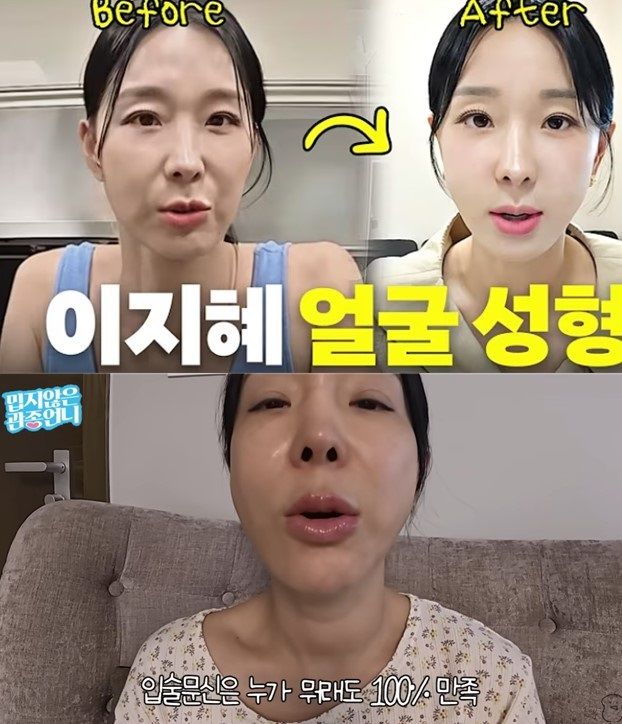 [서울=뉴시스] 혼성그룹 '샵' 출신 방송인 이지혜가 성형외과 시술 사실을 밝혔다. (사진=유튜브 채널 '밉지 않은 관종언니' 캡처) 2025.10.10. photo@newsis.com *재판매 및 DB 금지