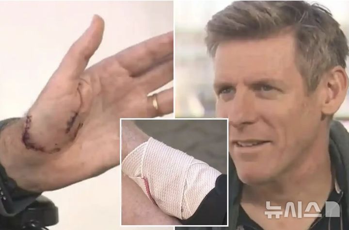 [뉴시스] 카탈리나 해협에서 영국인 수영선수 크리스토퍼 머레이가 백상아리 두 마리에게 물리는 사고가 발생했다.(사진=더선 2025.10.09 