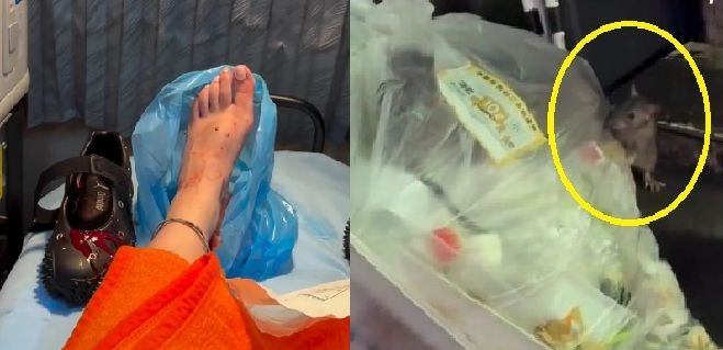 [ニューシース] 新宿で鼠にかまれて治療受けた女性. 2025.10.11. (写真=インスタグラム 