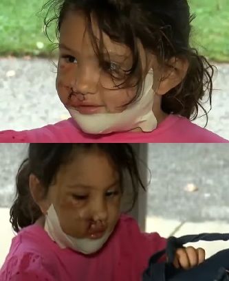 [뉴시스] 엄마와 산책 도중 핏불 테리어의 공격을 받은 카리나 팔라디노. 2025.10.13. (사진=미 매체 피플 캡처). *재판매 및 DB 금지