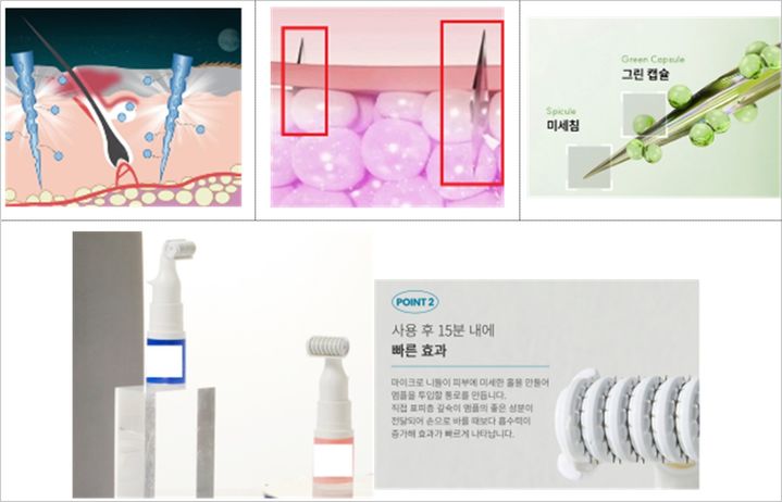 [서울=뉴시스] 피부 내 화장품 주입·전달 광고 적발 사례 (사진=식약처 제공) 2025.10.14. photo@newsis.com *재판매 및 DB 금지