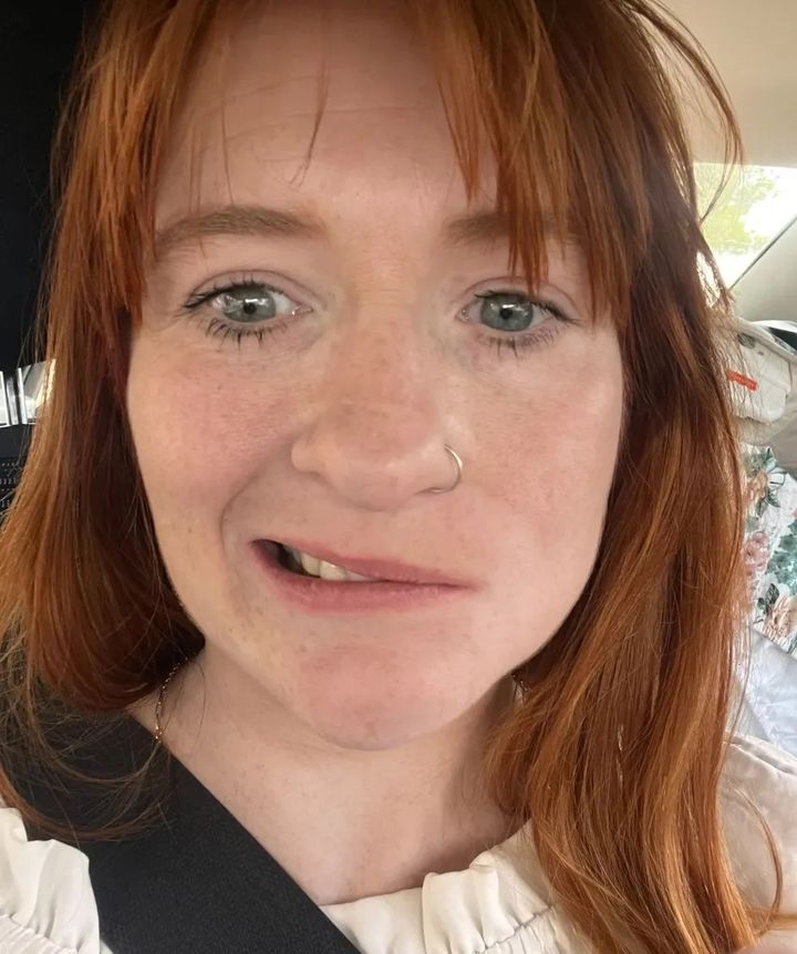 [뉴시스] 출산 뒤 안면 마비 증상을 겪은 30대 영국인 여성. (사진=케네디뉴스앤미디어) 2025.10.15 *재판매 및 DB 금지