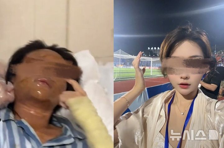 [서울=뉴시스]택배 폭탄에 피해를 입은 중국 스트리머 (사진 = 장난도시보 캡처)