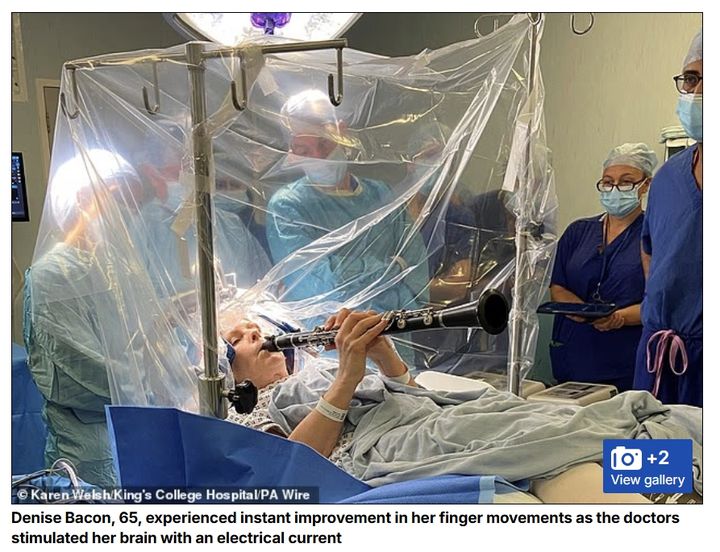 [서울=뉴시스] 파키슨병 환자 데니즈 베이컨(65)이 지난 7월 런던 킹스 칼리지 병원에서 뇌심부자극술(Deep Brain Stimulation·DBS)을 받는 동안 클라리넷 연주를 하고 있다. (사진: 데일리메일 홈페이지 캡처) 2025.12.08.