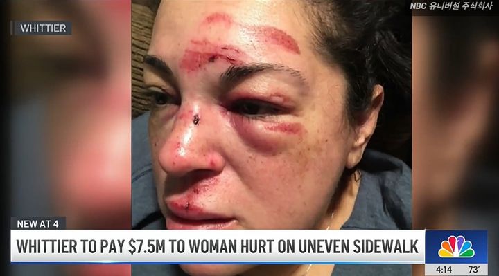 [뉴시스]보도블록에서 넘어져 부상을 입은 미국 여성 저스틴 구롤라의 모습. (사진=NBC4 캡처) 2025.10.21 *재판매 및 DB 금지