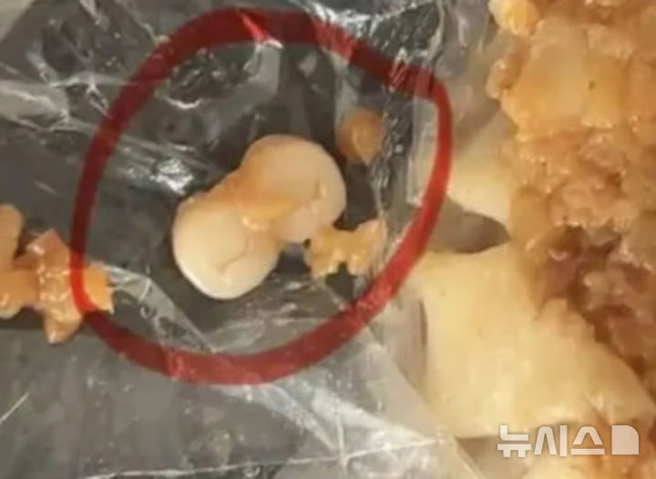 [뉴시스]중국의 한 여성이 광둥성 남부 둥관시에 있는 유명 지역 체인점에서 딤섬을 먹다가 사람 이빨 두 개를 발견했다고 제보했다.(사진=데일리메일)2025.10.21. 